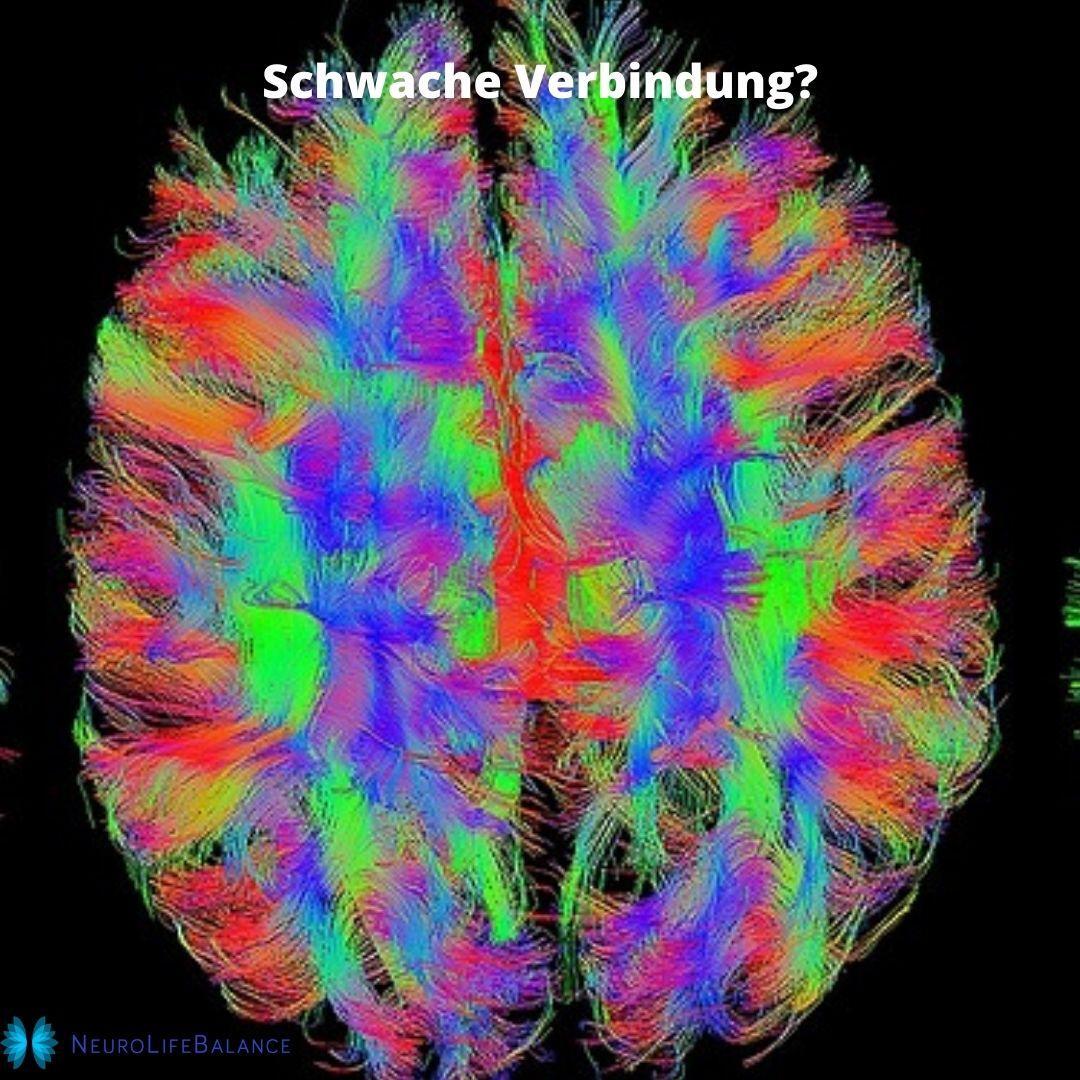 Die Cambridge-Studie: Schwache neuronale Verbindungen als Ursache für Lernschwierigkeiten und AD(H)S